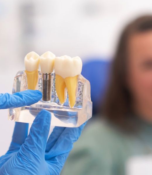 Dental Implants Galway